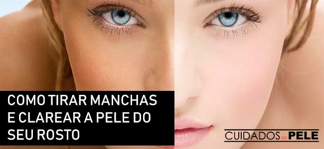 como tirar manchas do rosto